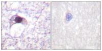 E2F-6 Polyclonal Antibody