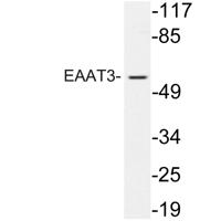 EAAT3 Polyclonal Antibody