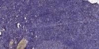 ECM1 Polyclonal Antibody