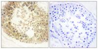 ECRG4 Polyclonal Antibody