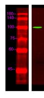 EDEM3 Polyclonal Antibody