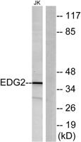 EDG-2 Polyclonal Antibody