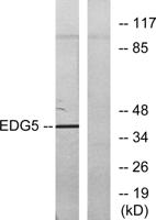 EDG-5 Polyclonal Antibody
