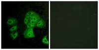 EDG-6 Polyclonal Antibody