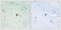 EDG-8 Polyclonal Antibody
