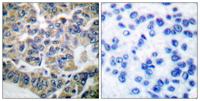 eEF2K Polyclonal Antibody