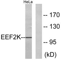 eEF2K Polyclonal Antibody