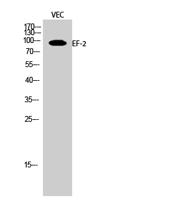 EF-2 Polyclonal Antibody