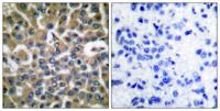 EF-2 Polyclonal Antibody