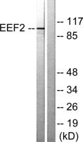 EF-2 Polyclonal Antibody