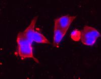 EF-2 Polyclonal Antibody