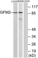 EF-G2 Polyclonal Antibody