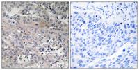 EF-Tu Polyclonal Antibody