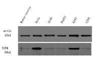 EF-Tu Polyclonal Antibody