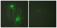 Eg5 Polyclonal Antibody