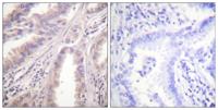 Eg5 Polyclonal Antibody