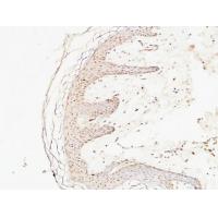 EGF Polyclonal Antibody