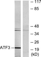ATF-3 Polyclonal Antibody