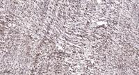 ATF-3 Polyclonal Antibody
