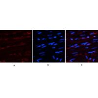 AR Polyclonal Antibody