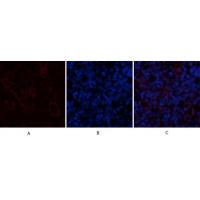 AR Polyclonal Antibody