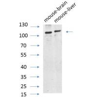 AR Polyclonal Antibody