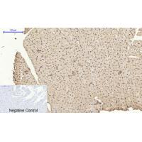 AR Polyclonal Antibody