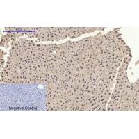 AR Polyclonal Antibody