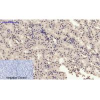 AR Polyclonal Antibody