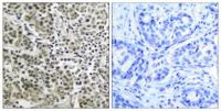 AR Polyclonal Antibody