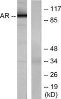 AR Polyclonal Antibody