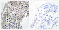 AR α2A Polyclonal Antibody
