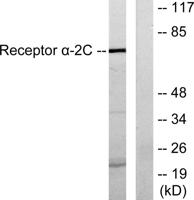 AR α2C Polyclonal Antibody