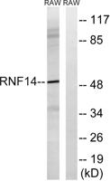 ARA54 Polyclonal Antibody