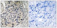 ARALAR Polyclonal Antibody
