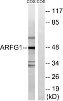 ARF GAP1 Polyclonal Antibody