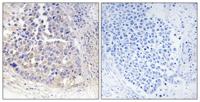 ARF4 Polyclonal Antibody