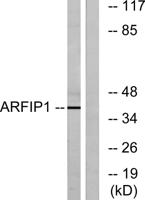 Arfaptin 1 Polyclonal Antibody