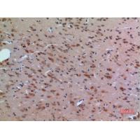 Arg Polyclonal Antibody