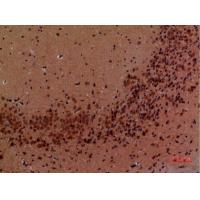 Arg Polyclonal Antibody