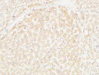Arginase I Polyclonal Antibody