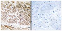 ARHGAP1 Polyclonal Antibody
