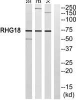 ARHGAP18 Polyclonal Antibody