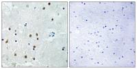 ARHGAP18 Polyclonal Antibody