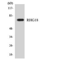 ARHGAP18 Polyclonal Antibody