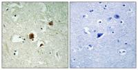 ARHGAP22 Polyclonal Antibody