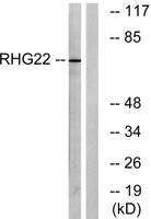 ARHGAP22 Polyclonal Antibody