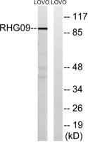 ARHGAP9 Polyclonal Antibody