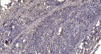 ARHGAP9 Polyclonal Antibody