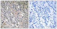ARHGEF9 Polyclonal Antibody
